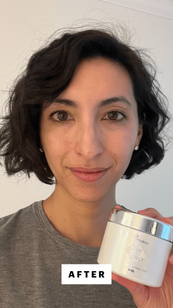 Selfie of Deanna Pai after using the SkinMedica Even  Correct Brightening Treatment Pads