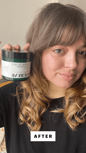 Selfie of Sarah Hoffmann after using the Some by Mi AHA BHA PHA 30 Days Miracle Truecica Clear Pad